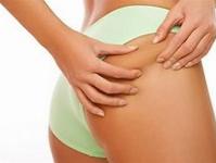How to use an anti-cellulite cream, what to look for in a store, and why home remedies are no worse What are anti-cellulite creams for?